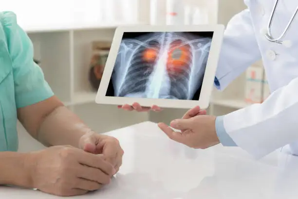 Doctor showing lung scan